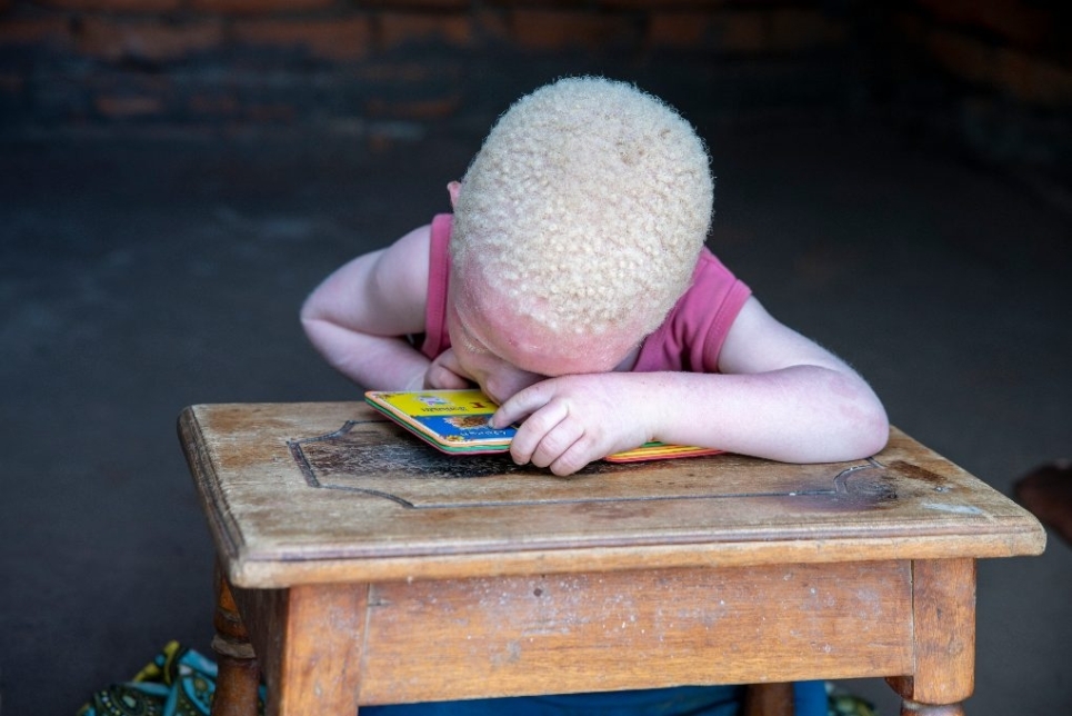 bimba con albinismo in africa che fa fatica a leggere