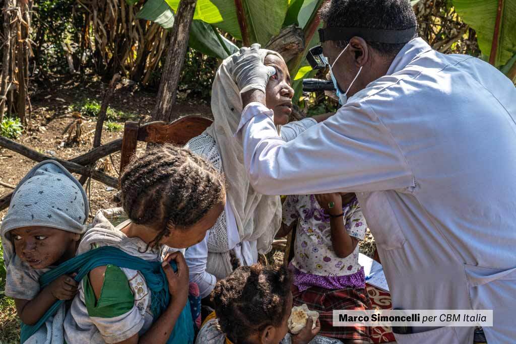 medico visita donna affetta da tracoma