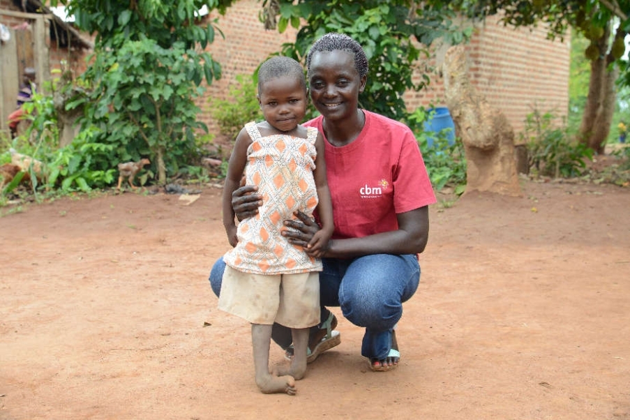 bimba con piede torto e operatrice in uganda