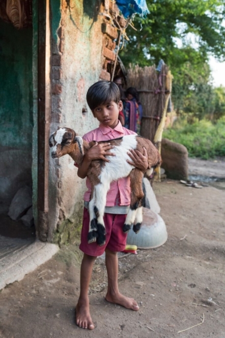 bambino con cataratta in india